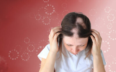 Long Covid is now linked with hair loss in women